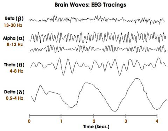 Figure 2: Brain Waves - EEG Tracings