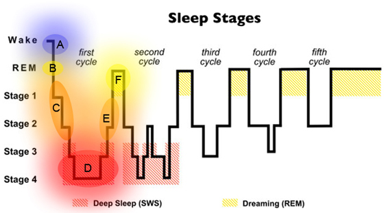 Figure 3: Sleep Stages Revisited
